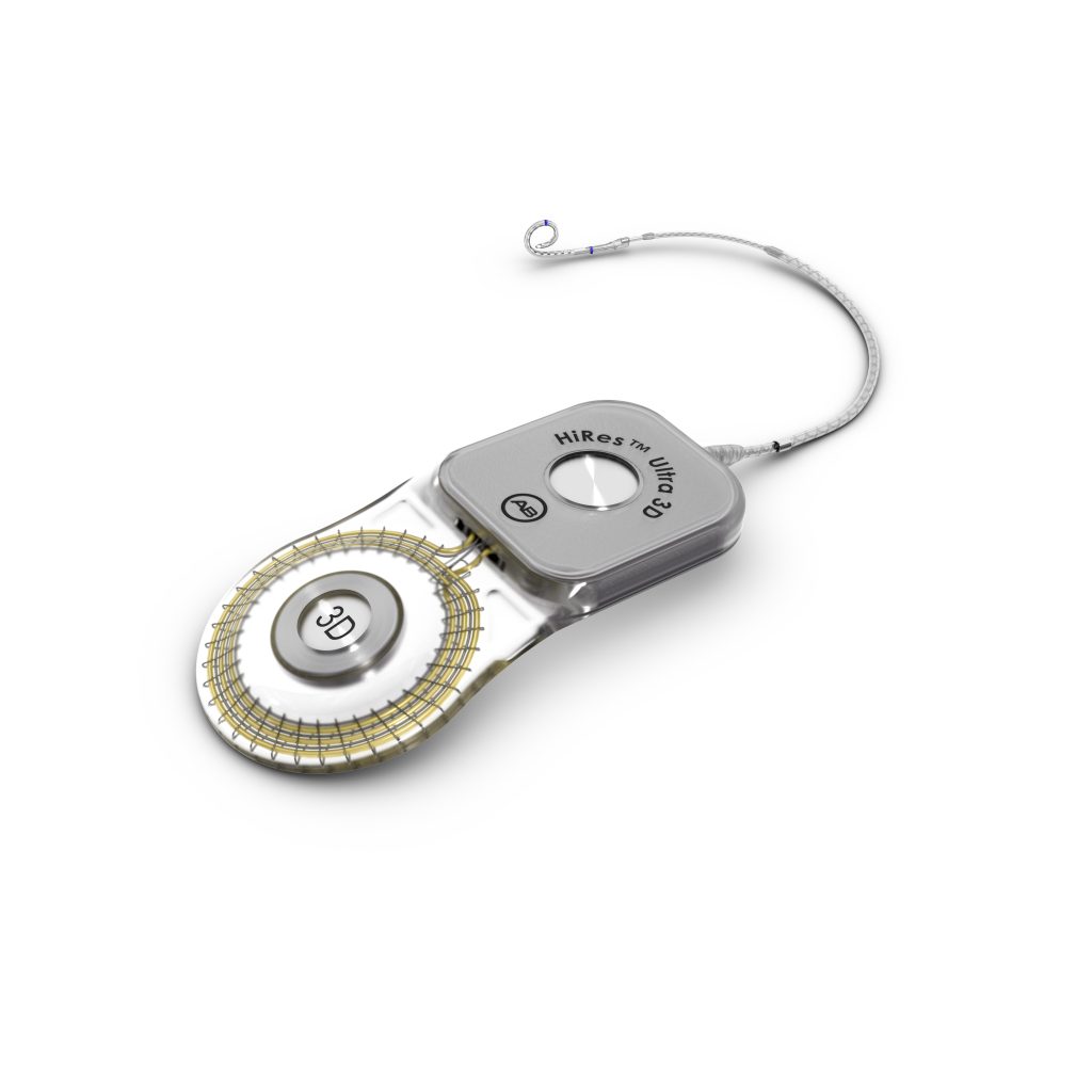 Tại sao máy trợ thính cần Roger?