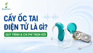 cay oc tai dien tu la gì