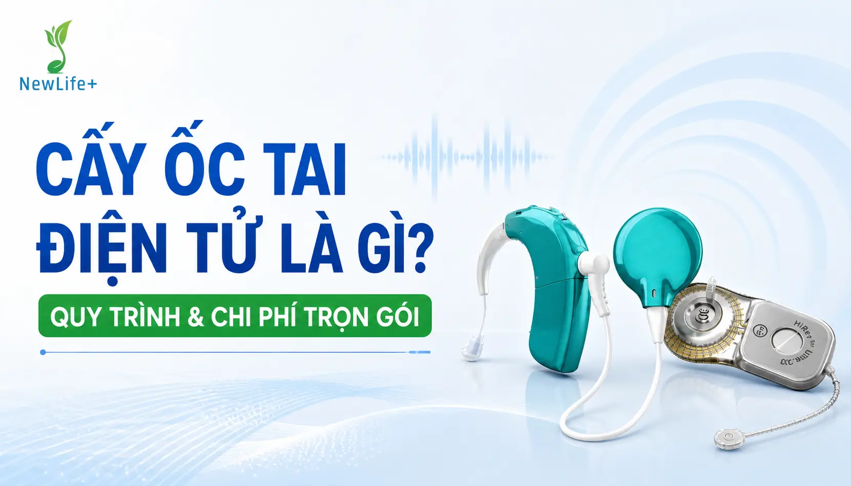 cay oc tai dien tu la gì