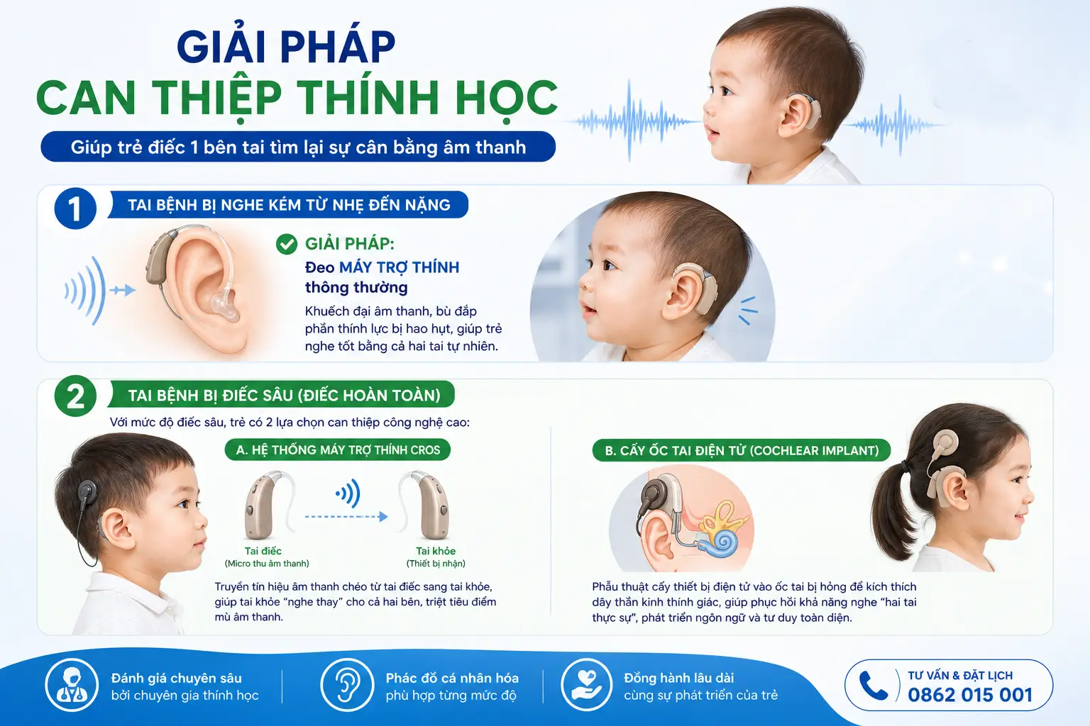 giải pháp nghe kém 1 bên
