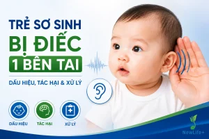 trẻ sơ sinh bị điếc 1 bên tai